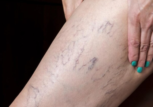 Design sem nome (5) (1) Design sem nome (5) (1)